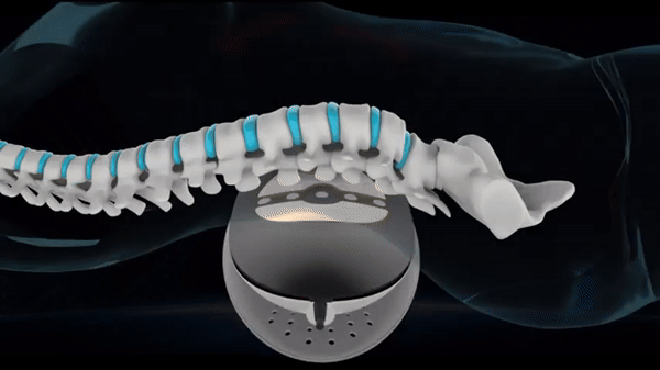 LUMBARCARE™ LUMBAR TRACTION DEVICE